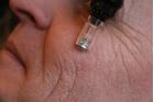 4. Anti Age Collagen Induction Therapy